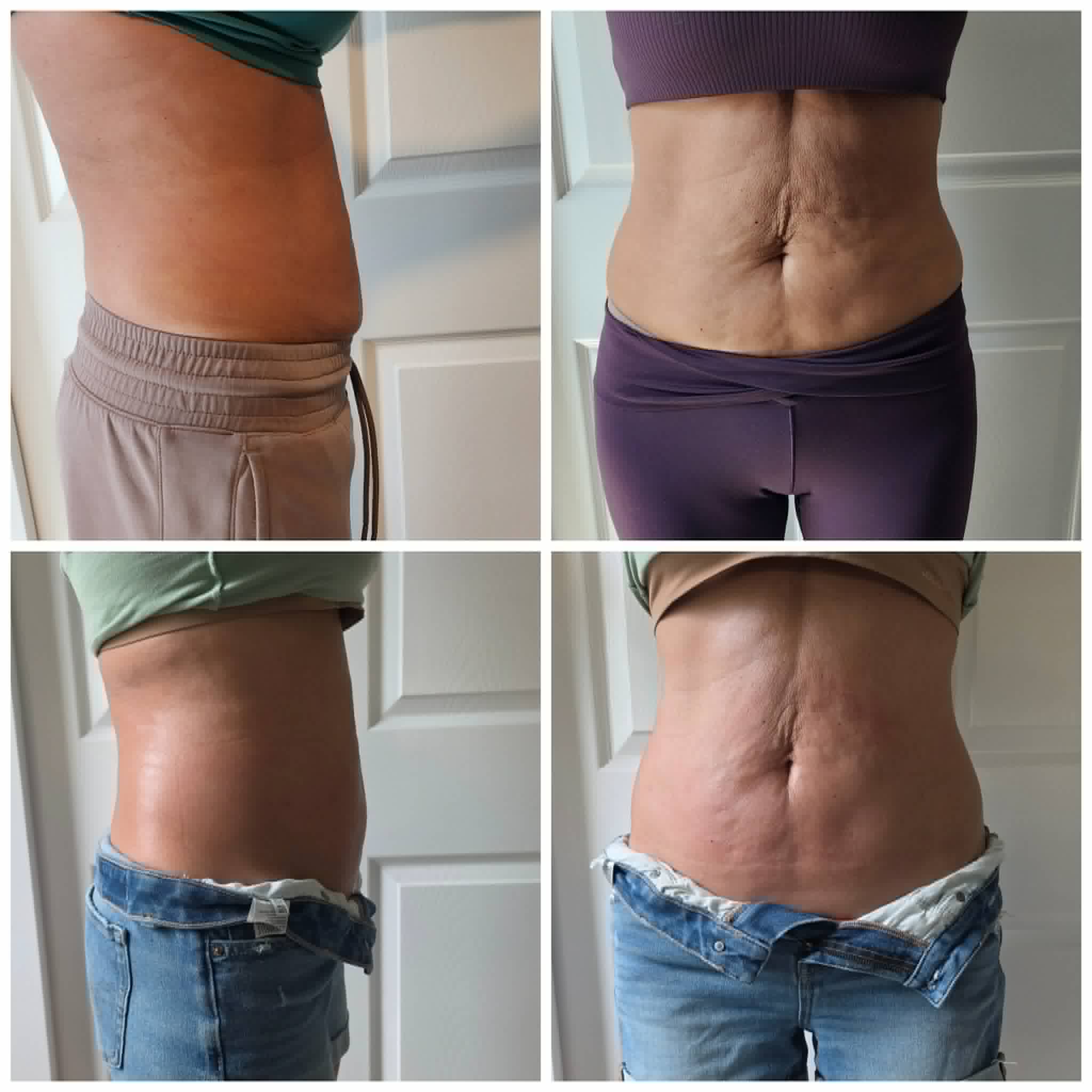 Before and after body sculpting result from Goddess Body Studio